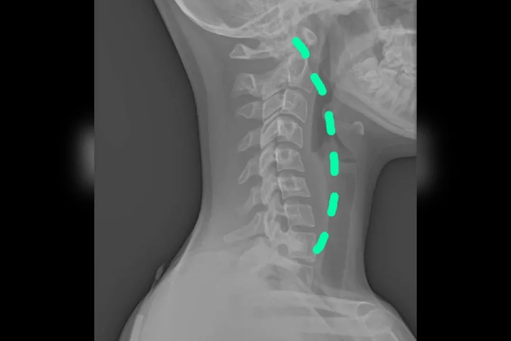 clinica masos madrid osteopatía